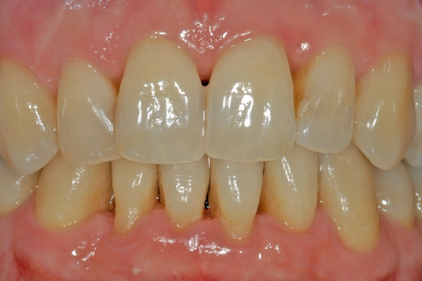 studio-odontoiatrico-acrea-viterbo-implantologia-cover